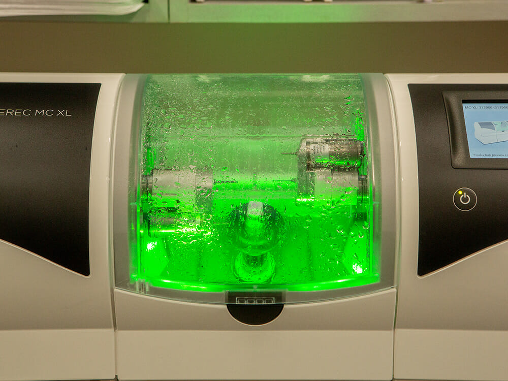 CEREC_Crowns