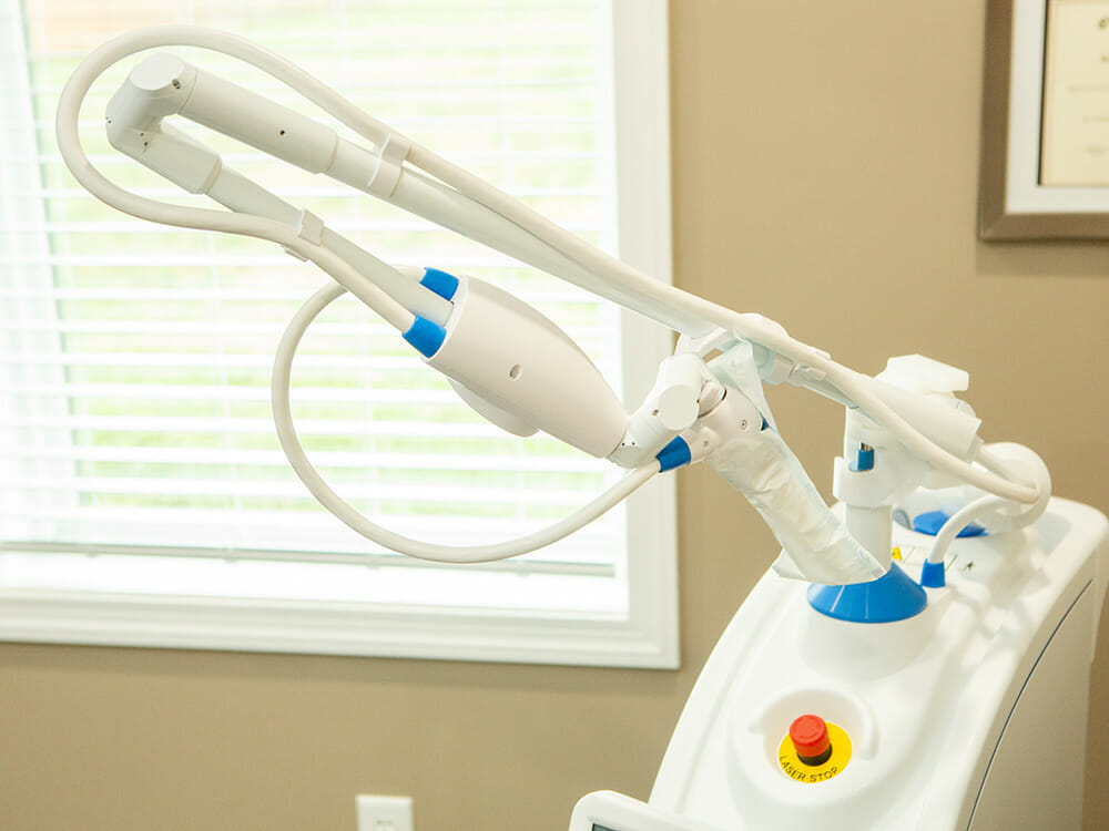 Cosmetic_Tooth_Contouring