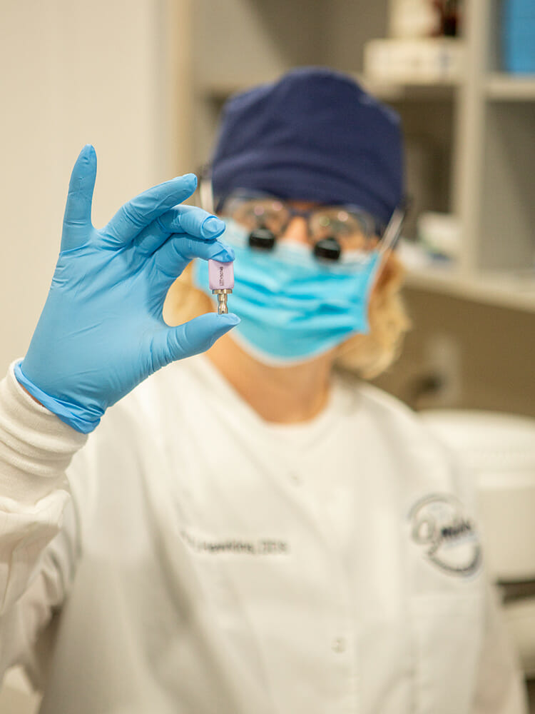 TeethXpress_Dental_Implants